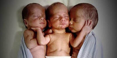 Mother rushes to emergency room to deliver triplets: then nurses look closer at their faces and freeze