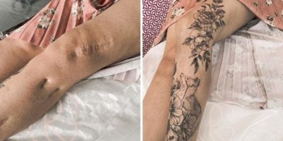 Tattoos can help you turn scars into something beautiful