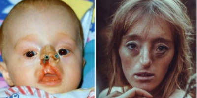 Young girl was born with rare facial defect – now she’s breaking beauty standards with her modelling career