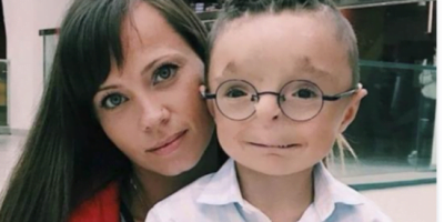 Woman adopts a boy no one wanted to adopt: see what he looks like now