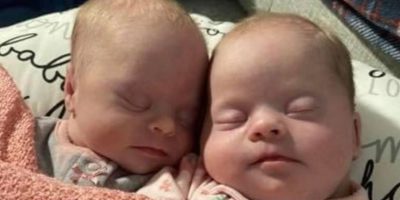 Mom of Rare Twins with Down Syndrome Shows How Beautiful They Are in Spite of Critics