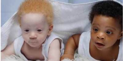 Mom Of Black And White Twins Boys Often Gets Asked Which One Is Hers