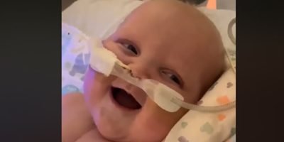 Baby boy smiles for the first time after his second open-heart surgery